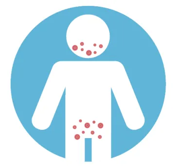 Icon of person with red dots by mouth and genitals 