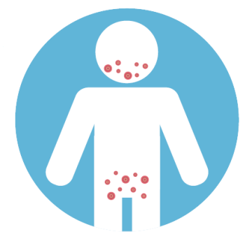 Icon of person with red dots by mouth and genitals 